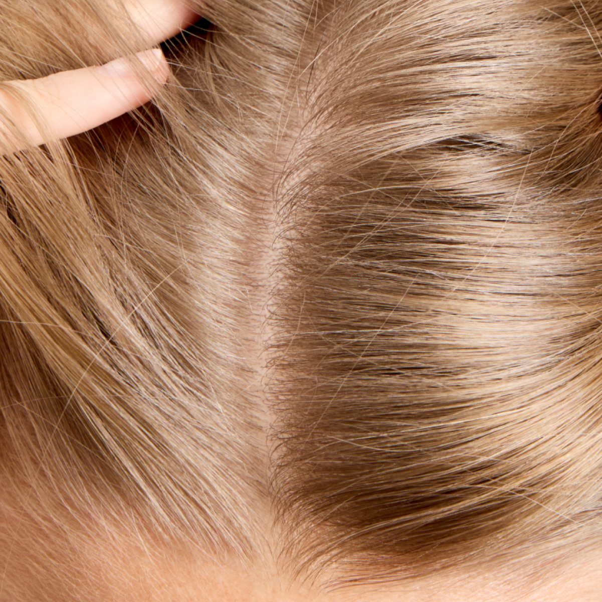 How to Improve Scalp Health: Five Things You Need to Know