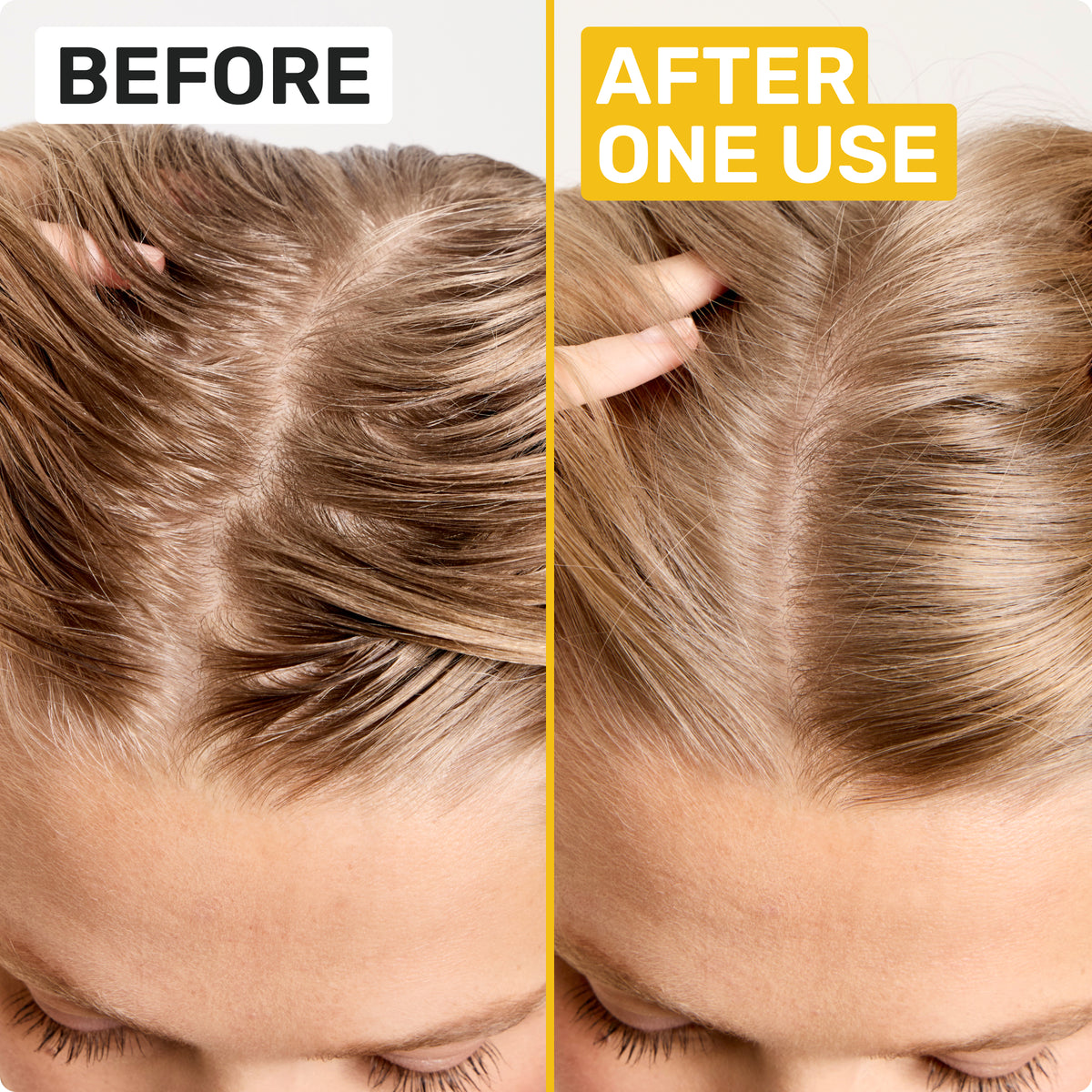 BEFORE 
AFTER ONE USE